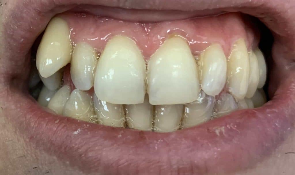 Simple Cosmetic Dental Care - After